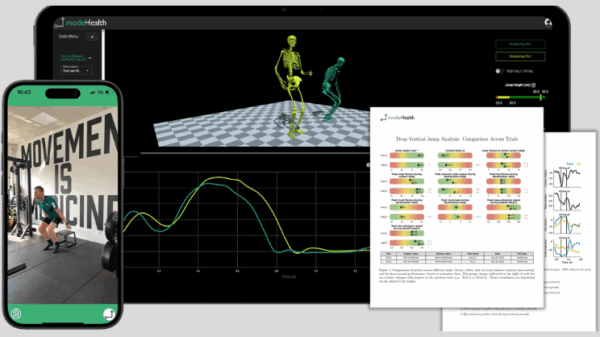 Belgian-American startup Model Health raises $1M to turn any smartphone into a sports lab