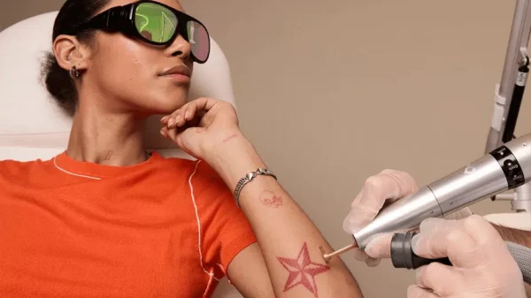 French tattoo removal specialist Ray Studios raises €10 million to scale across Europe
