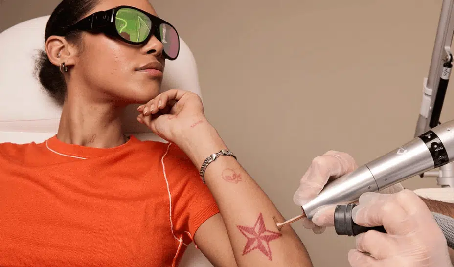 French tattoo removal specialist Ray Studios raises €10 million to scale across Europe