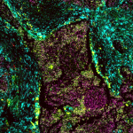 HAGA.BIO raises SEK 20.9M to advance spatial biology for clinical translation