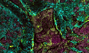 HAGA.BIO raises SEK 20.9M to advance spatial biology for clinical translation