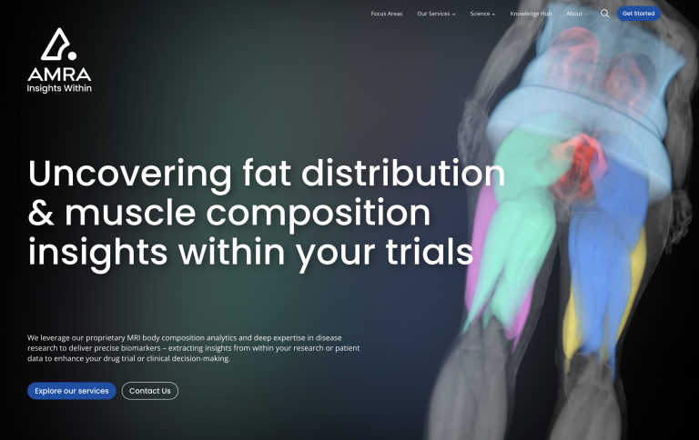 HealthCap Invests in Linköping's AMRA Medical to Accelerate Global Growth in Quantitative MRI