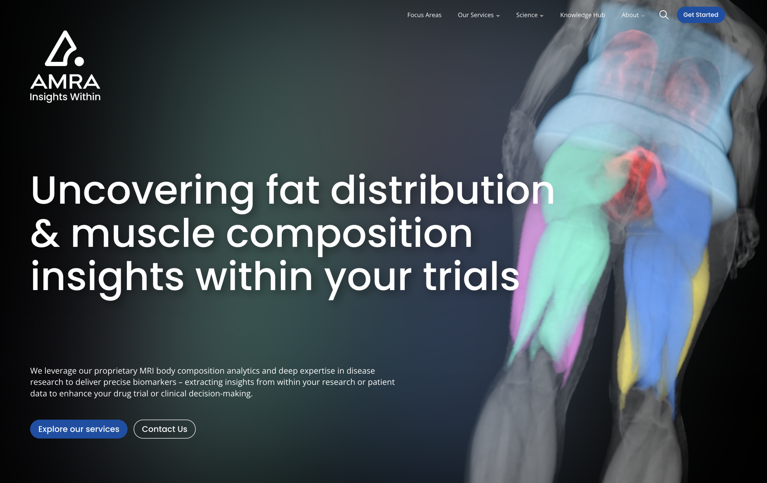 HealthCap Invests in Linköping's AMRA Medical to Accelerate Global Growth in Quantitative MRI