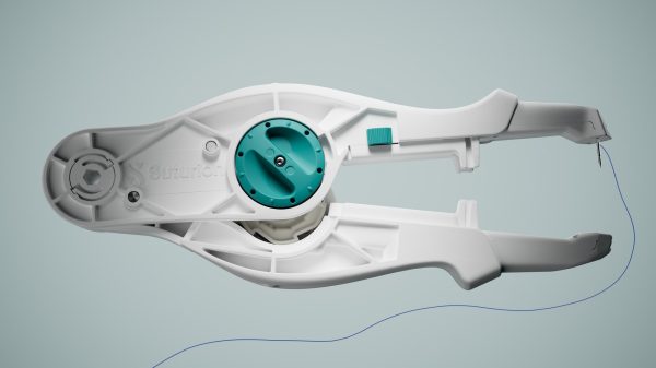 HealthTech Funding: Sweden's Suturion Secures SEK 20M Convertible Investment from Cradle Growth to Accelerate Commercial Expansion